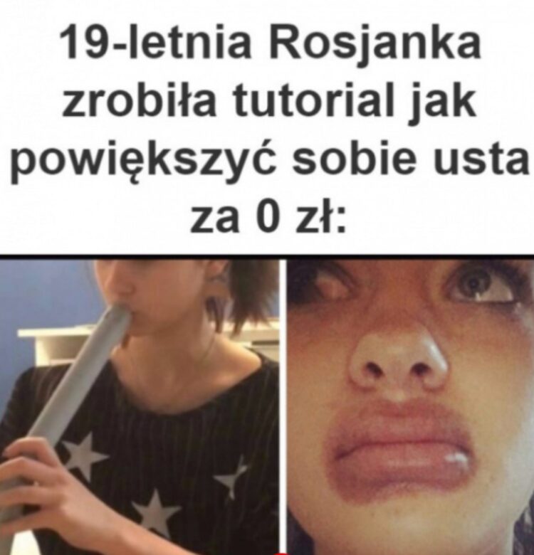 Tanie powiększanie ust